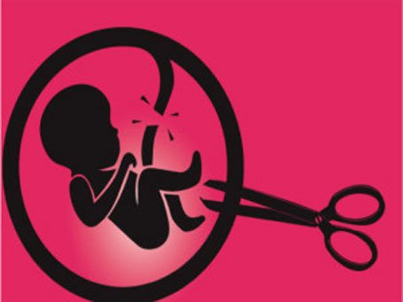 गर्भपतनको ‘ट्रेन्ड’ : २५ प्रतिशत २० वर्षमुनिका