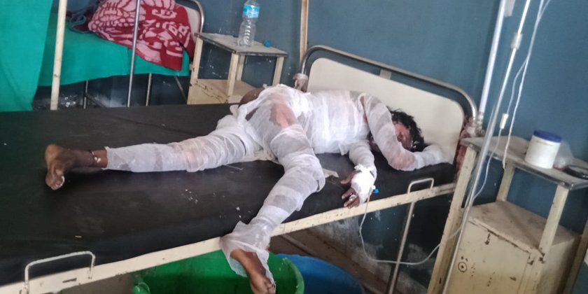 माइती पक्षको आरोप: ज्वाइँ र सम्धिनीले छोरी जलाएको
