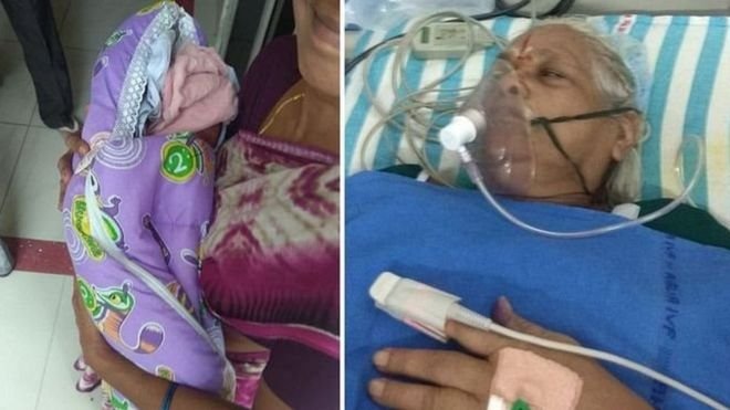 बाँझोपनको उपचार गरेको वर्षौँपछि भारतमा ७३ वर्षीया वृद्धाले जन्माइन् जुम्ल्याहा बच्चा
