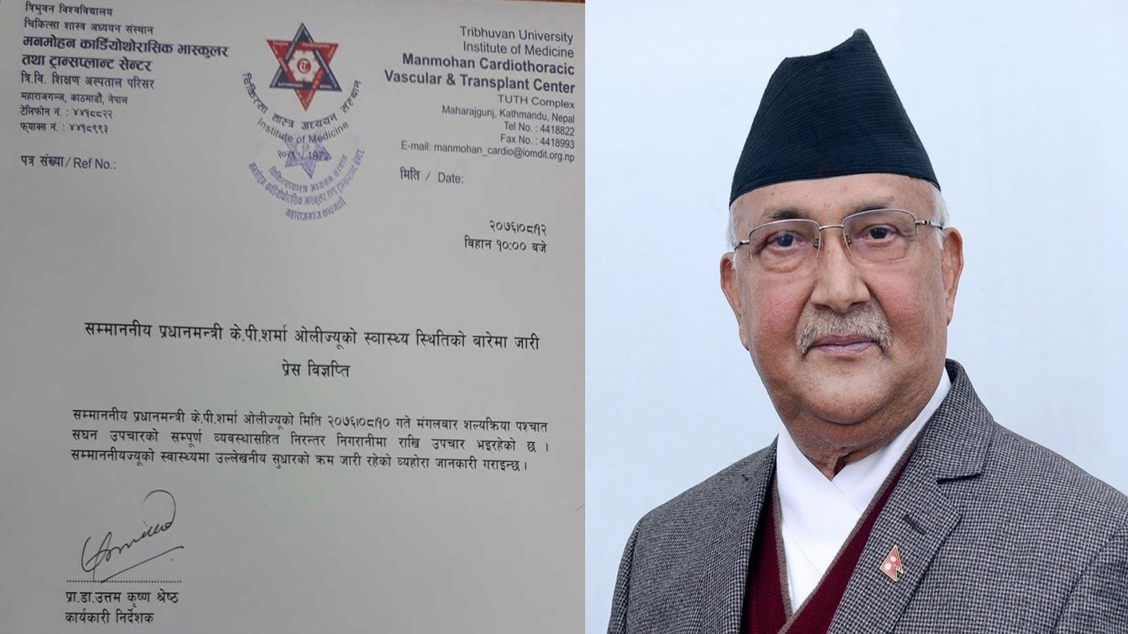 प्रधानमन्त्री ओलीको स्वास्थ्यमा सुधार