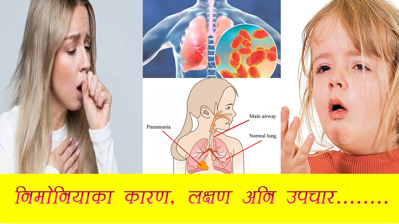 निमोनिया के हो ? यसको पहिचान कसरी गर्ने ?
