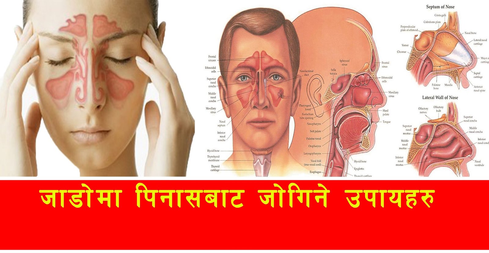 जाडोमा पिनासबाट कसरी बच्ने……………